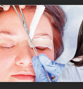 Op. Dr. Gözde Akyol; Göz Kapağı Estetiği ile Daha Dinç Bir İfade Mümkün