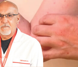 Sivrisinek Kaynaklı Chikungunya Virüsüne Karşı Uyarı