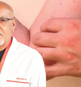 Sivrisinek Kaynaklı Chikungunya Virüsüne Karşı Uyarı