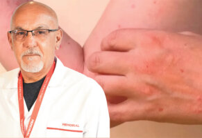 Sivrisinek Kaynaklı Chikungunya Virüsüne Karşı Uyarı
